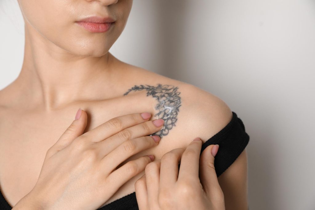 Tattoo removal Renewal Laser MedSpa | A Boutique Laser Med Spa | Lake Worth, FL